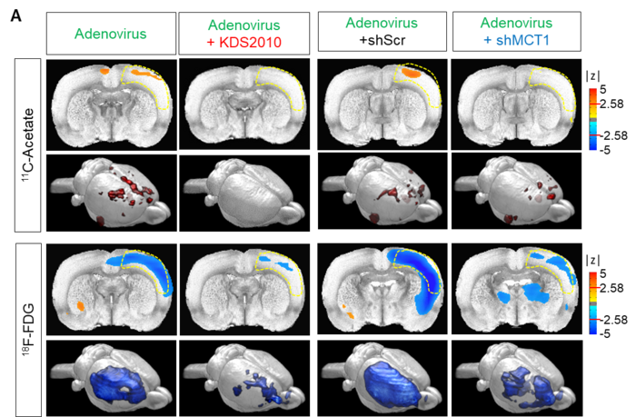 11C-acetate and 18F-FDG in vivo micro-PET imaging in adenovirus model (reactive astrogliosis model). A. Left, parametric images from a voxel-based comparison of 11C-acetate and 18F-FDG PET imaging in adenovirus model with or without KDS2010 treatment. Right, parametric images from a voxel-based comparison of 11C-acetate and 18F-FDG PET imaging in adenovirus model with scrambled-shRNA or MCT1-shRNA.