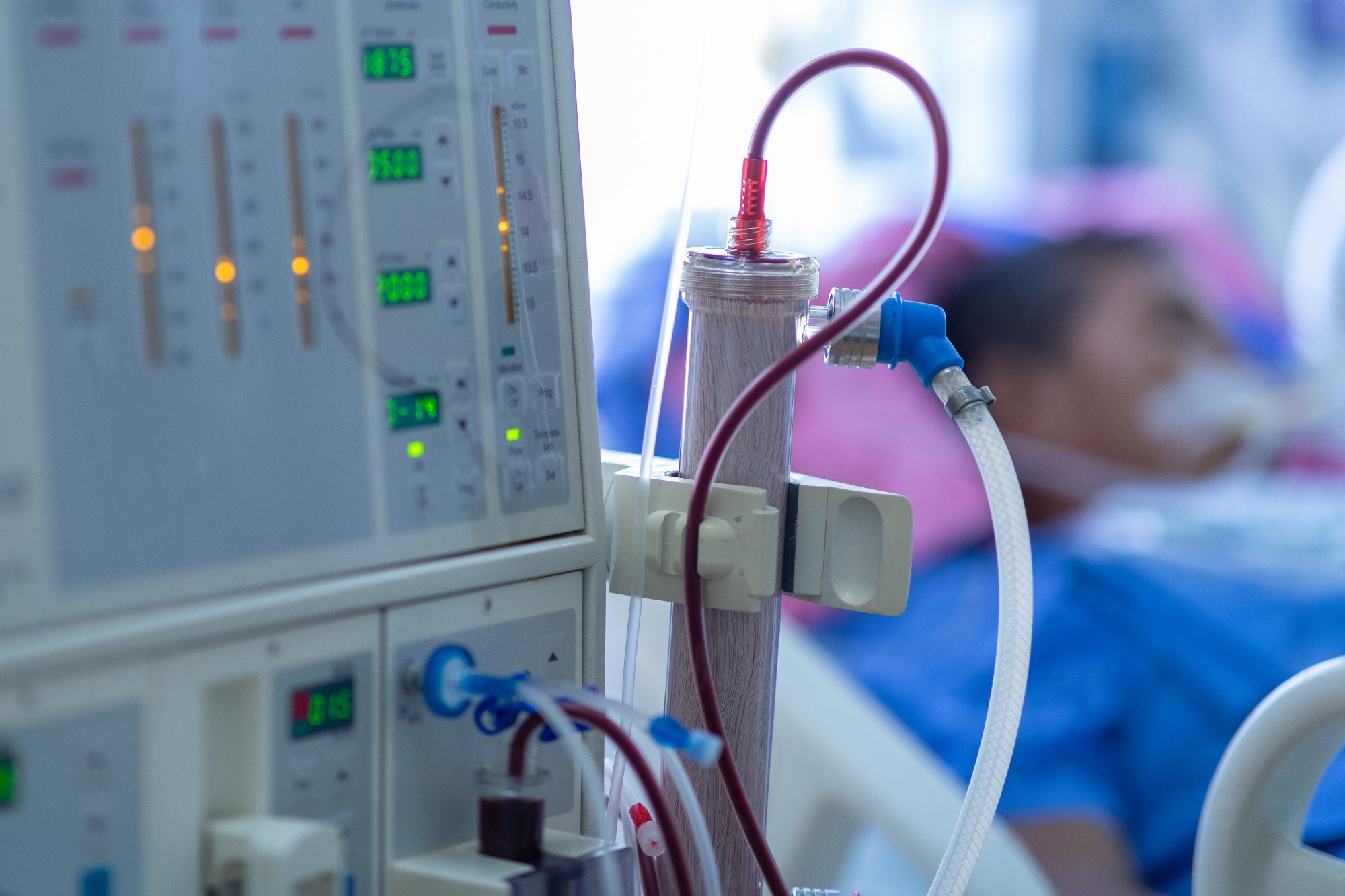 Study: Letermovir vs Valganciclovir for Prophylaxis of Cytomegalovirus in High-Risk Kidney Transplant Recipients. Image Credit: Hospital man / Shutterstock