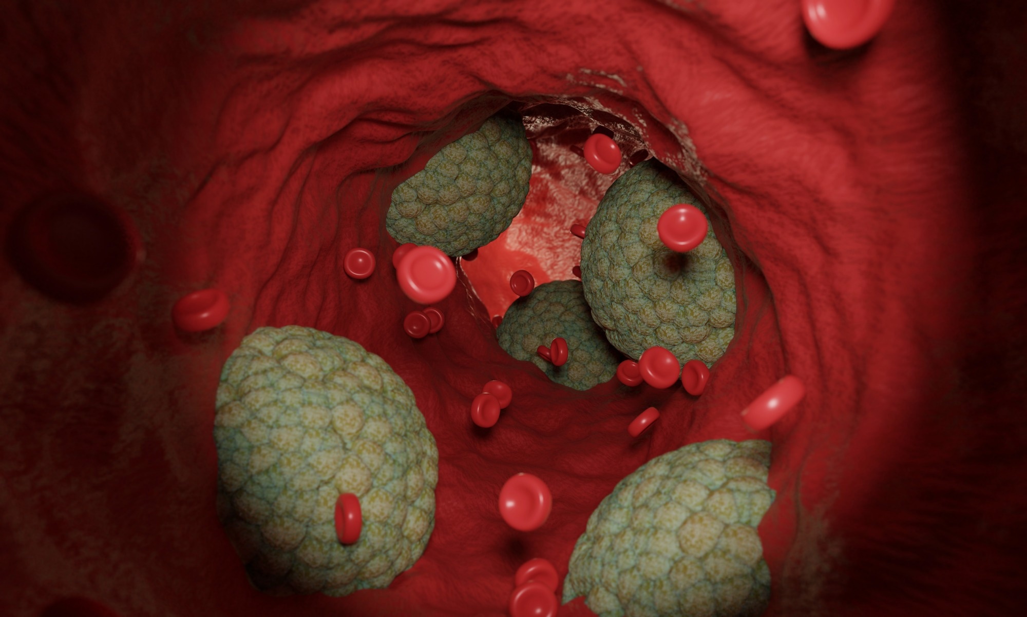 Study: Is cholesterol a risk factor for breast cancer incidence and outcome? Image Credit: BOKEH STOCK / Shutterstock.com