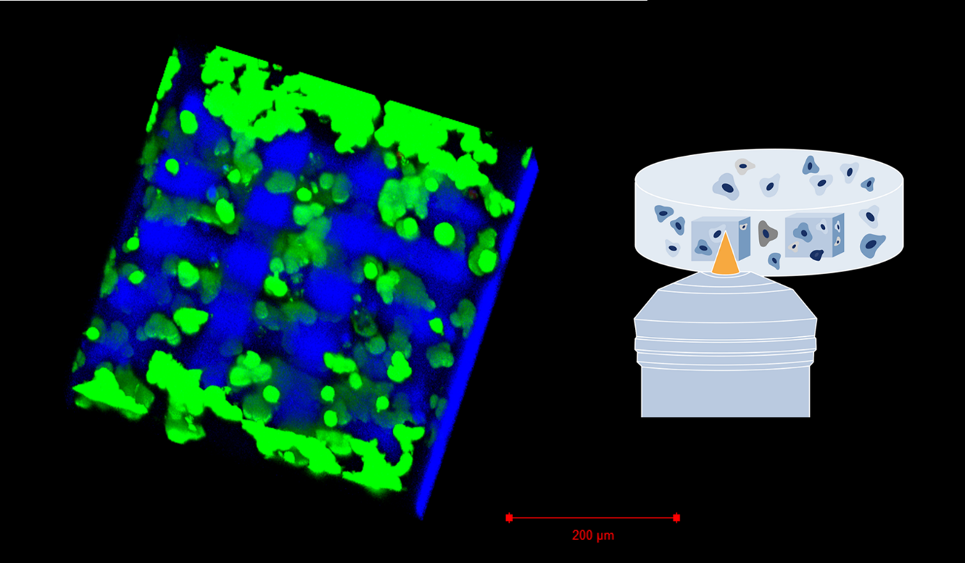 HU3DINKS project to develop human tissue-based bioinks for 3D bioprinting