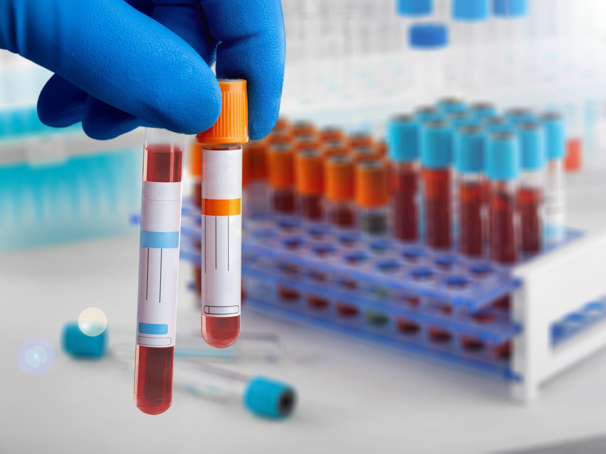 Antibodies against multiple post-translationally modified proteins aid in diagnosis of autoimmune hepatitis and associate with complete biochemical response to treatment