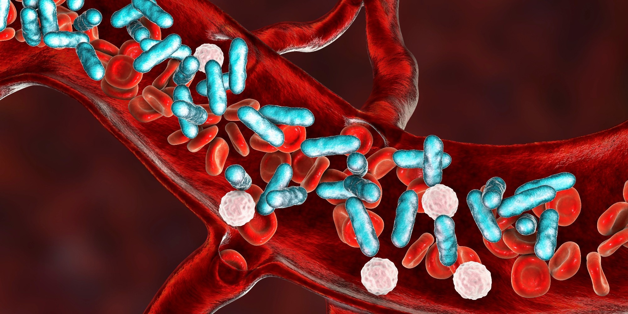 Predicting sepsis using a combination of clinical information and molecular immune markers sampled in the ambulance