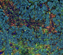Flexible Spatial Biology Solution for Up to 8-Plex Amplification in Two Days: CST Launches SignalStar™ Multiplex IHC