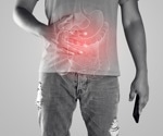 Is long COVID triggering irritable bowel syndrome? Arizona study to investigate