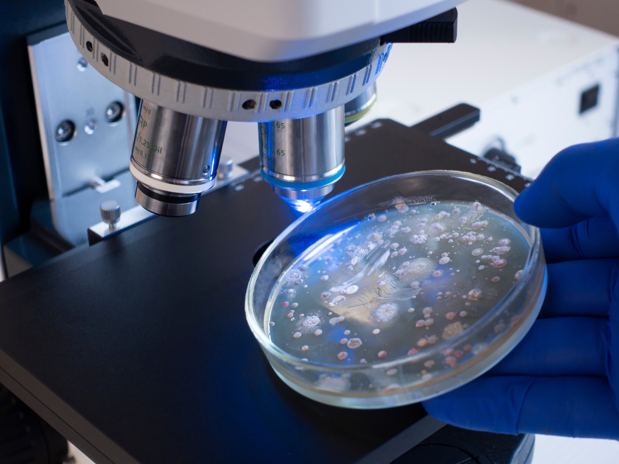 Study: Tumor-resident Lactobacillus iners confer chemoradiation resistance through lactate-induced metabolic rewiring. Image Credit: Prrrettty/Shutterstock.com