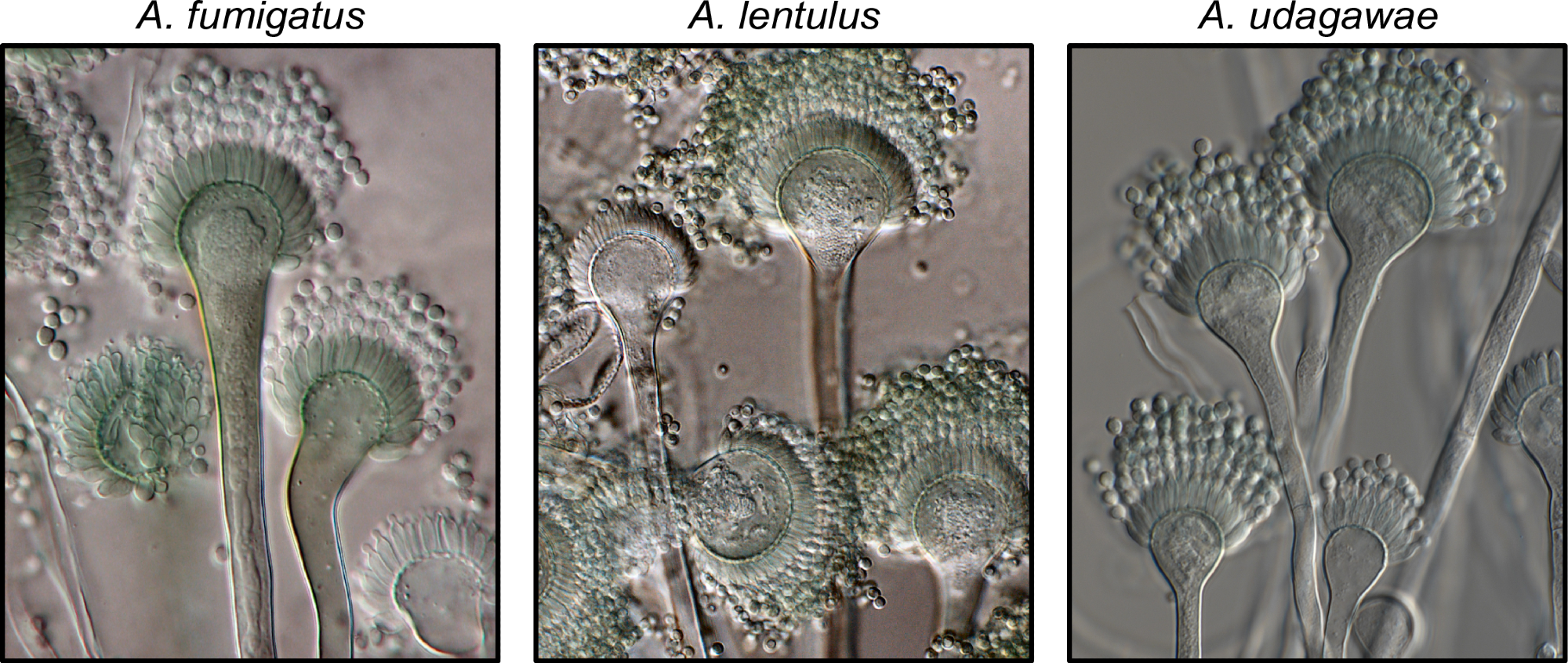 Exemplary known and cryptic pathogenic species of Aspergillus. (Left) Aspergillus fumigatus is a well-known and major human fungal pathogen. The cryptic species (Middle) Aspergillus lentulus and (Right) Aspergillus udagawae can also cause human disease but may be difficult to diagnose owing to their morphological similarity to A. fumigatus. Images were kindly provided by Dr. Jos Houbraken. https://doi.org/10.1371/journal.ppat.1011704.g001