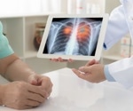 Pioneering study finds predictive biomarker in lung adenocarcinoma