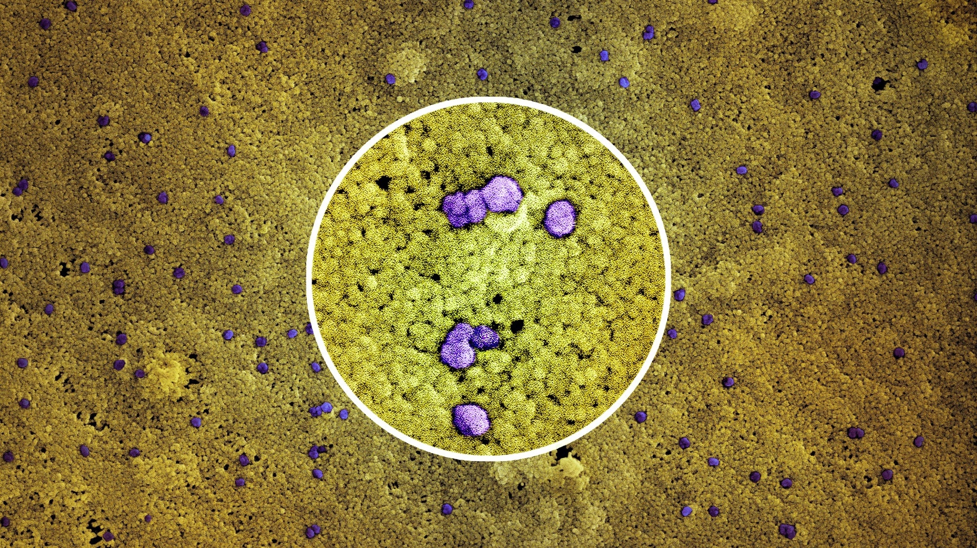 Study: XBB.1.5 monovalent mRNA vaccine booster elicits robust neutralizing antibodies against emerging SARS-CoV-2 variants. Image Credit: NIAID