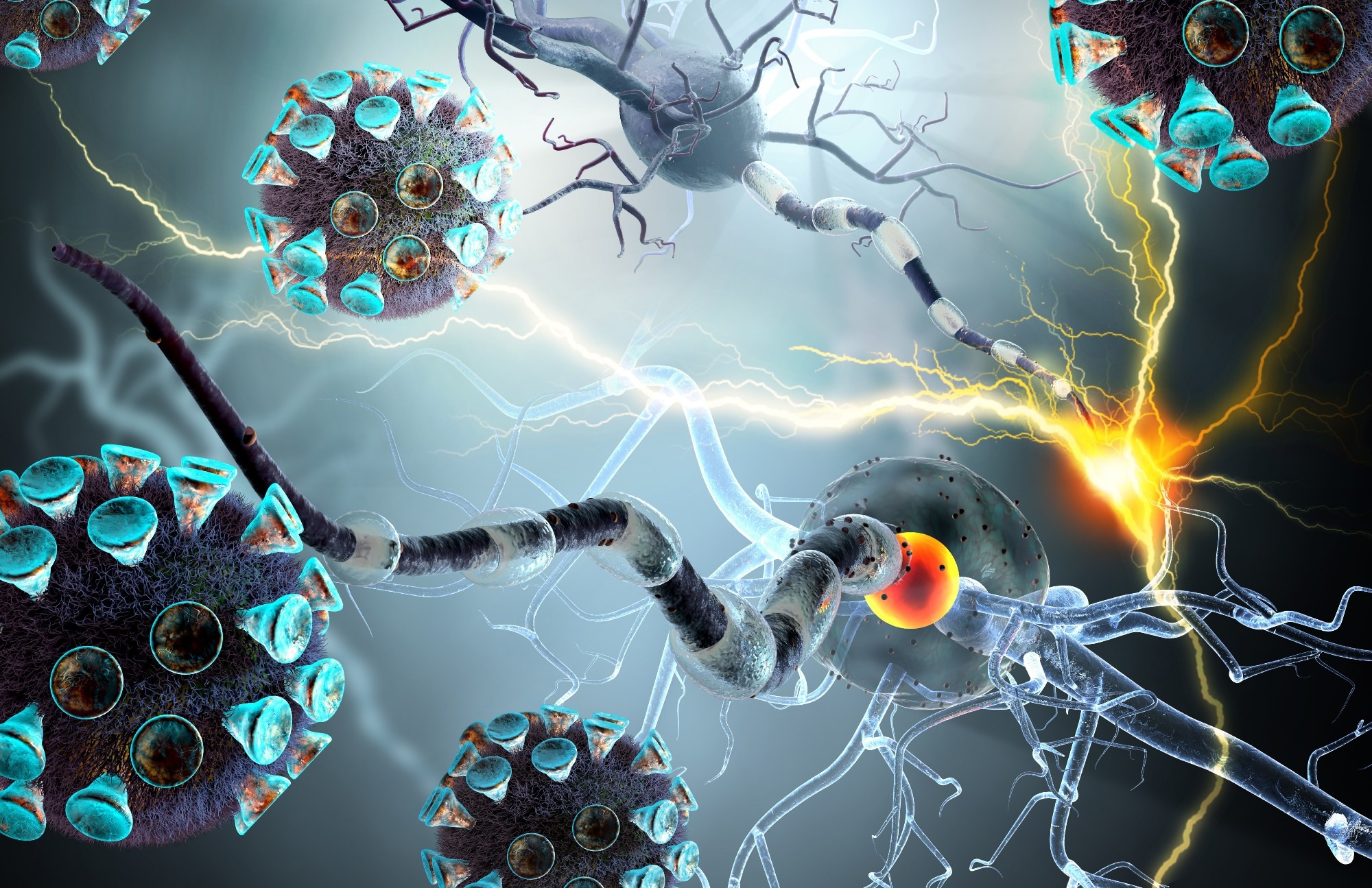 Study: ost-COVID cognitive deficits at one year are global and associated with elevated brain injury markers and grey matter volume reduction: national prospective study. Image Credit: Ralwell / Shutterstock