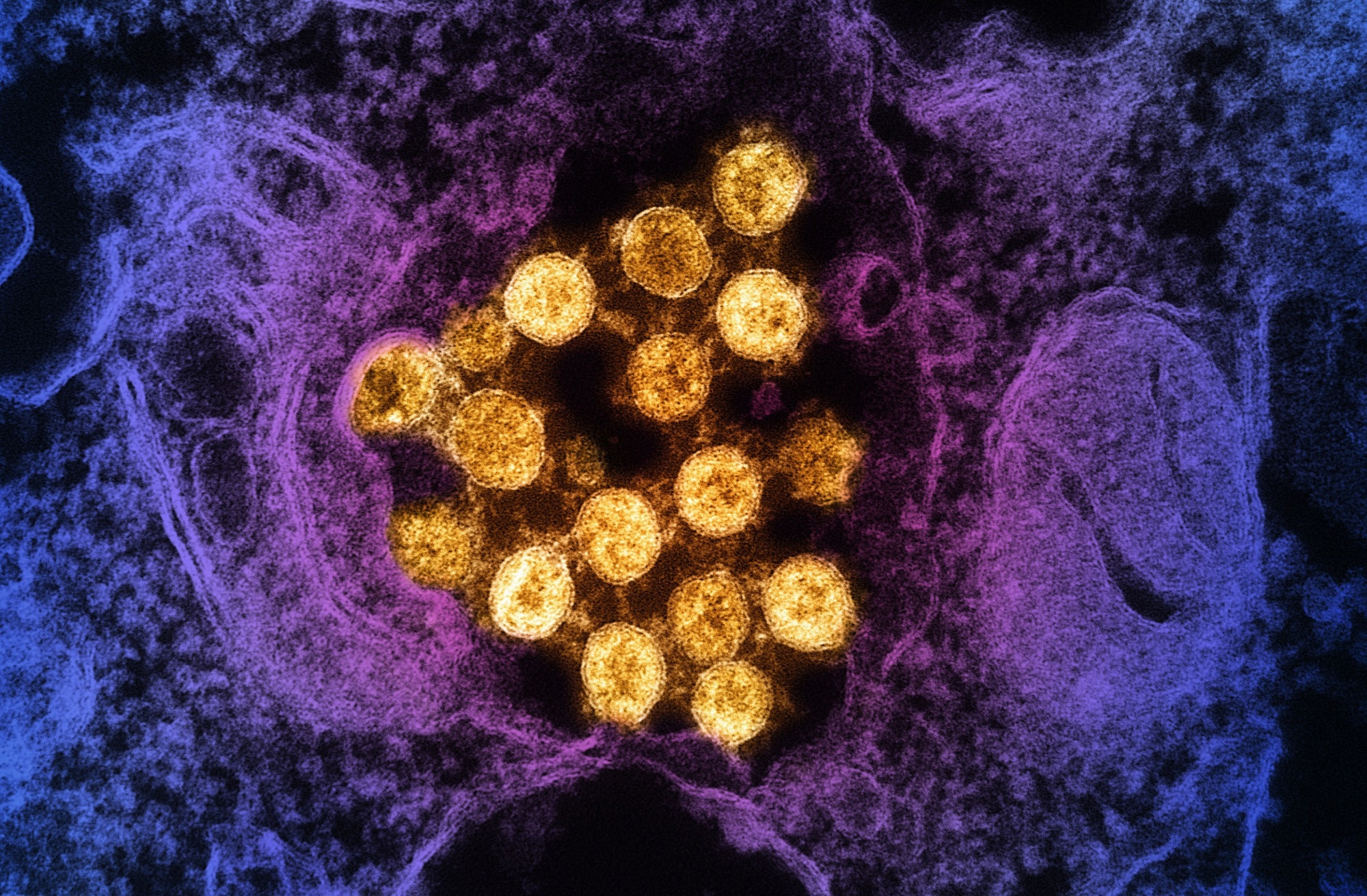 Rapid Communication: Humoral immune escape by current SARS-CoV-2 variants BA.2.86 and JN.1, December 2023. Image Credit: NIAID