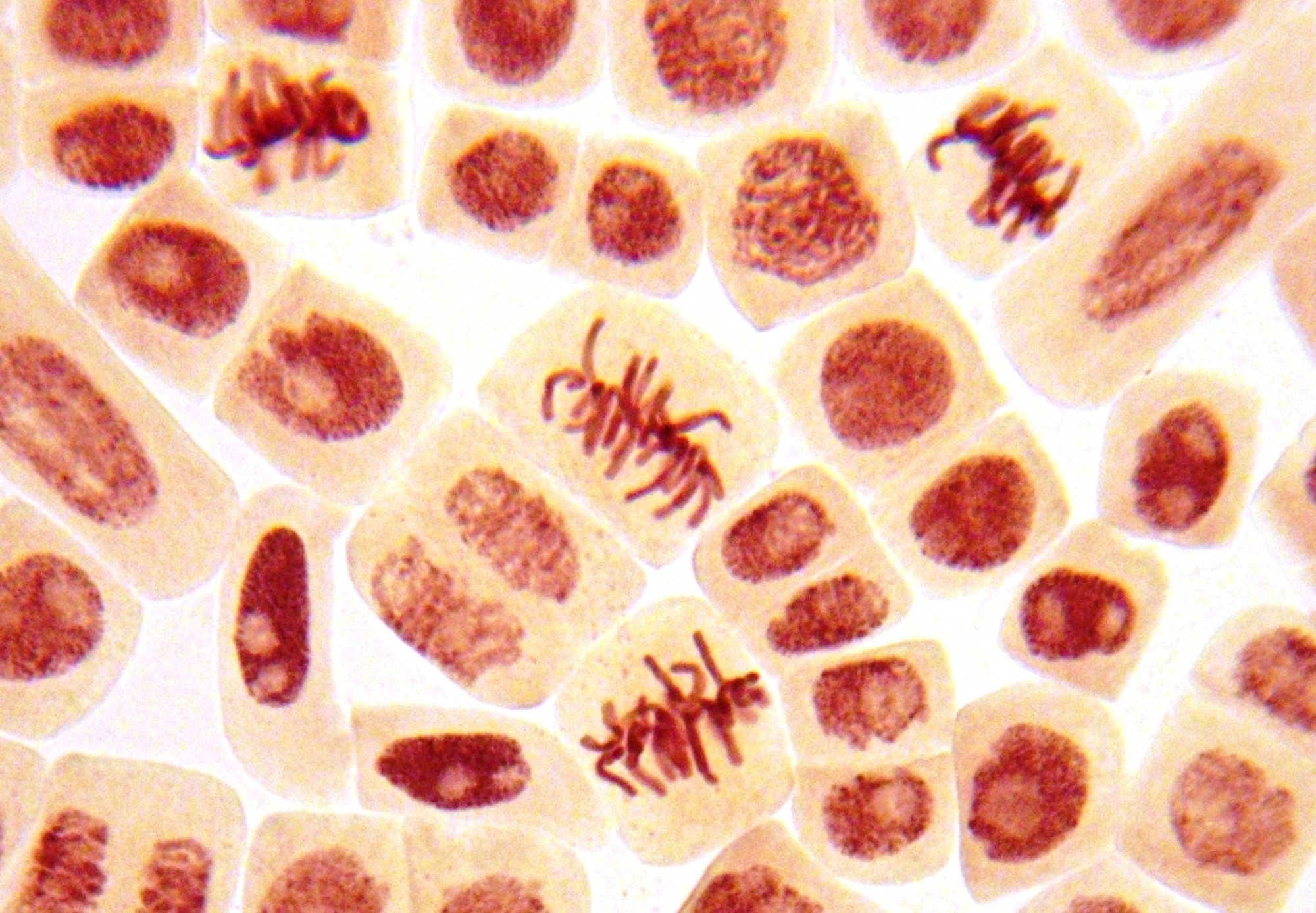 Study: Genetic determinants of micronucleus formation in vivo. Image Credit: Dimarion/Shutterstock.com