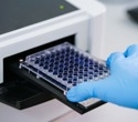 Get the best out of your microplate reader: recommendations for use