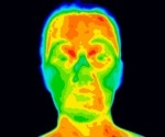 Facial temperature can predict heart disease with higher accuracy than current methods