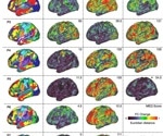 Psilocybin reconfigures brain networks, showing potential for lasting therapeutic effects