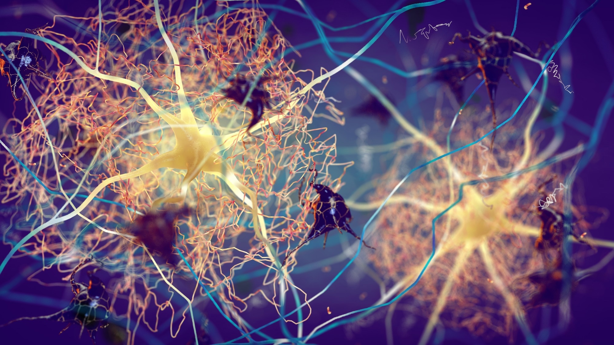 Study: Selective suppression of oligodendrocyte-derived amyloid beta rescues neuronal dysfunction in Alzheimer’s disease. Image Credit: nobeastsofierce / Shutterstock