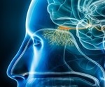 Microplastics found in the human brain via the olfactory pathway