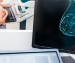 AI detects breast cancer years before diagnosis from mammograms