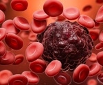 Scientists identify drug-resistant bone marrow cells linked to poor outcomes in fast-growing leukemia