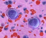 New study explores obecabtagene autoleucel for adults with hard-to-treat leukemia