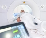 AI predicts mortality with whole-body MRI for personalized health insights