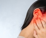 Why does tinnitus worsen after naps?