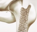 Can yogurt and kefir help prevent osteoporosis? Scientists examine the facts