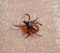 CDC confirms black-legged ticks can cause red meat allergy in humans