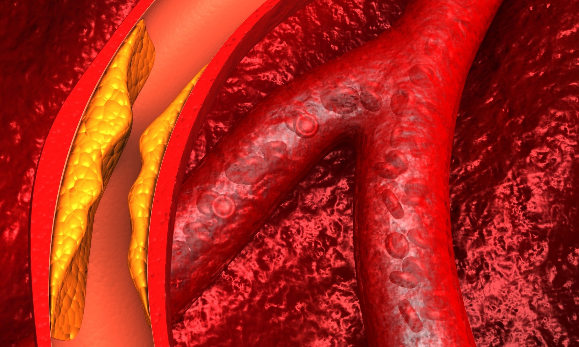 Study: Safety and Efficacy of Obicetrapib in Patients at High Cardiovascular Risk. Image Credit: Explode / Shutterstock