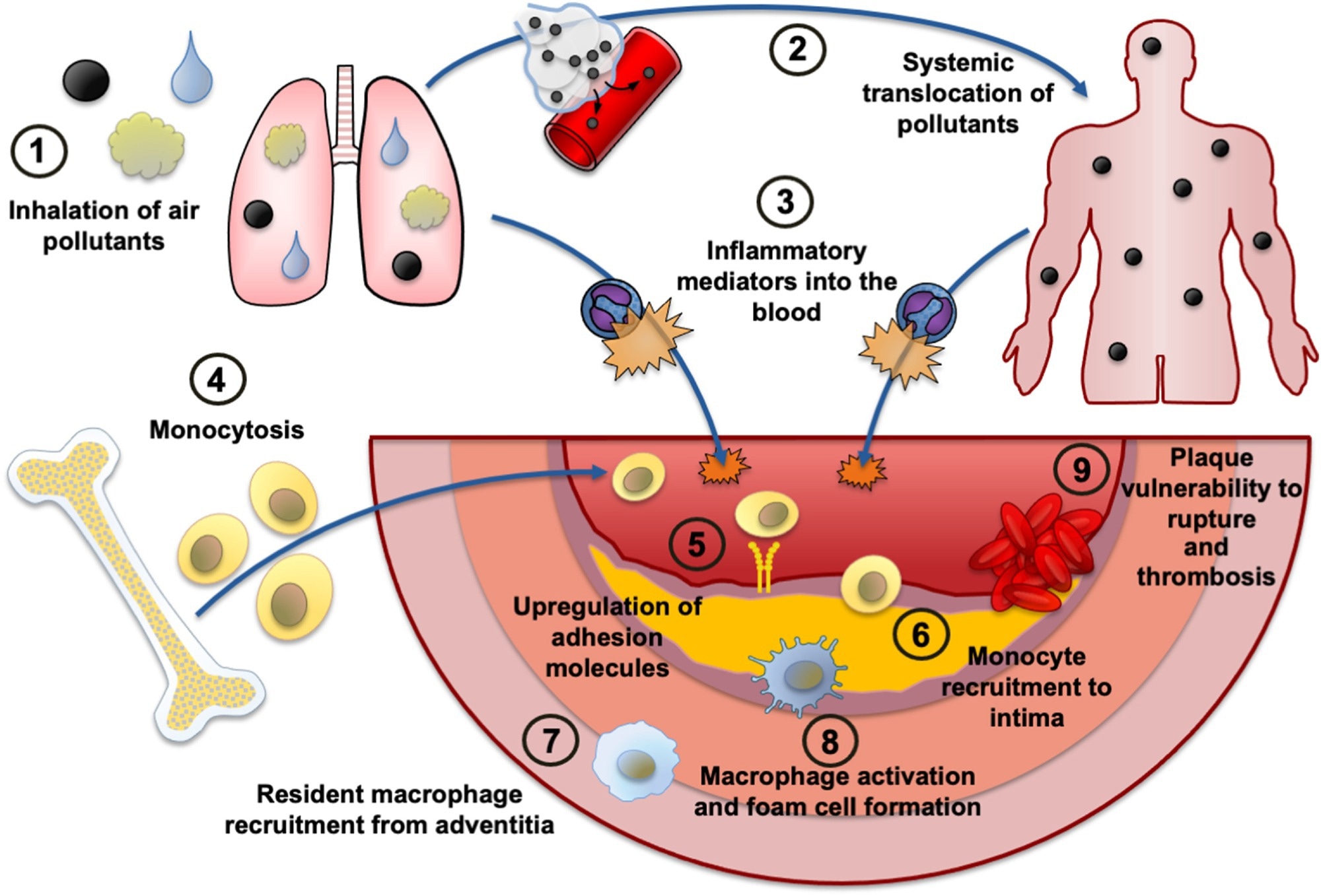 Potential mechanisms by which air pollutants promote atherosclerosis through inflammation.