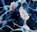 Blood test pinpoints early Alzheimer’s risk with high accuracy