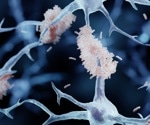 Blood test pinpoints early Alzheimer’s risk with high accuracy