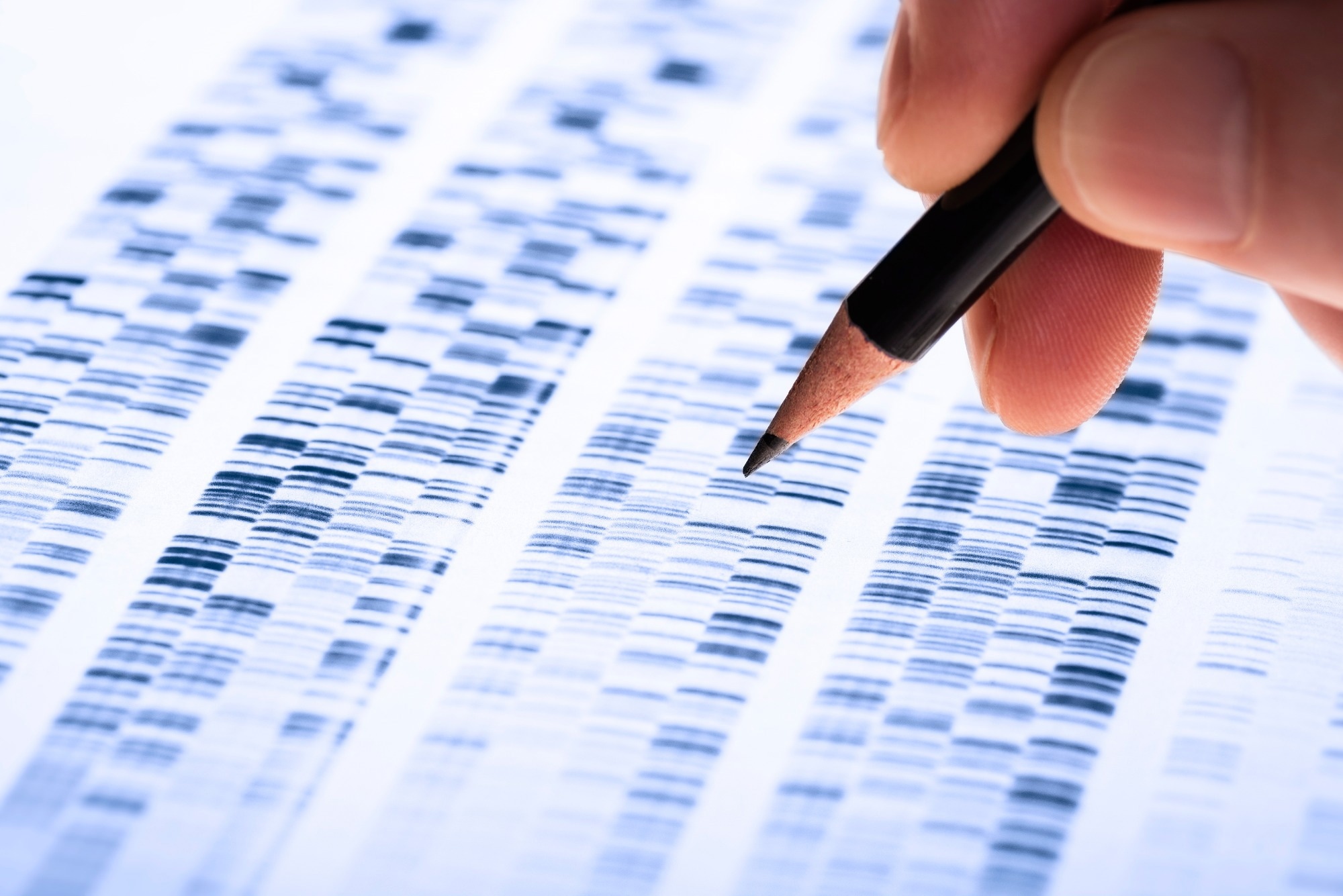 Study: Switch-like gene expression modulates disease risk. Image Credit: gopixa / Shutterstock