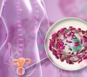 Eating habits directly influence vaginal microbiome, research finds