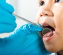 Even healthy eating can’t guarantee cavity-free kids, study reports