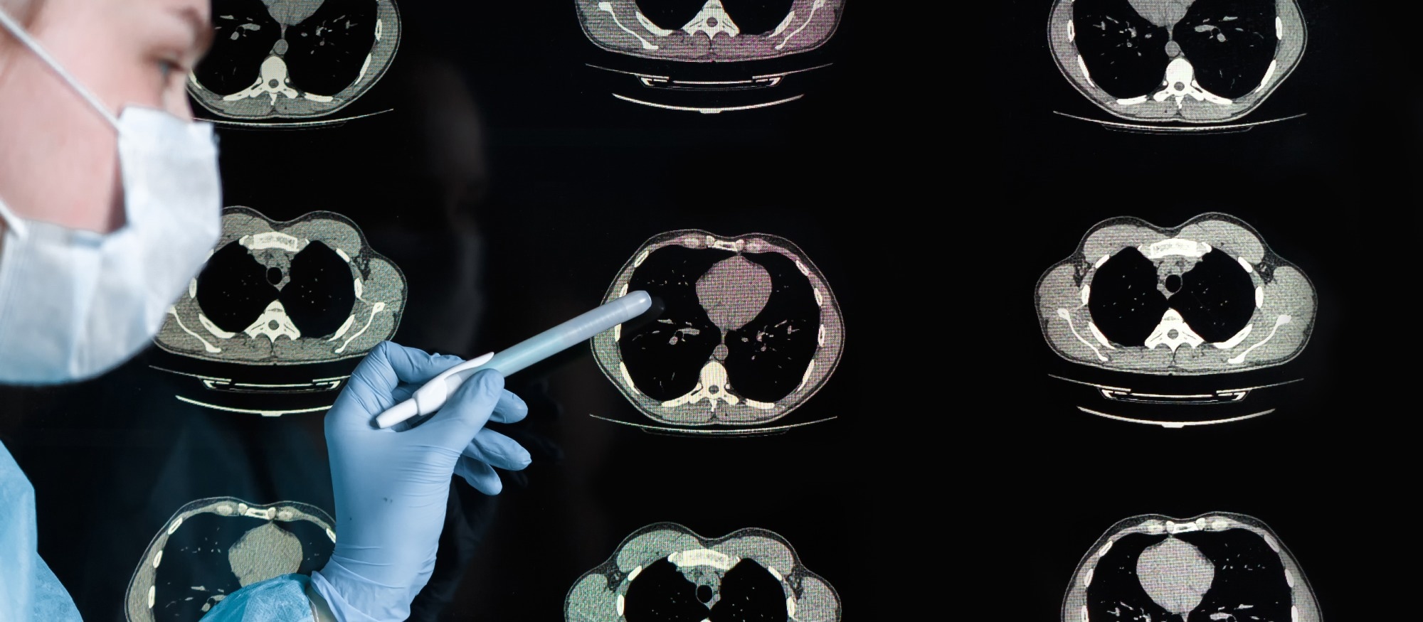 Study: Accelerated brain ageing during the COVID-19 pandemic. Image Credit: Shyntartanya / Shuttertock