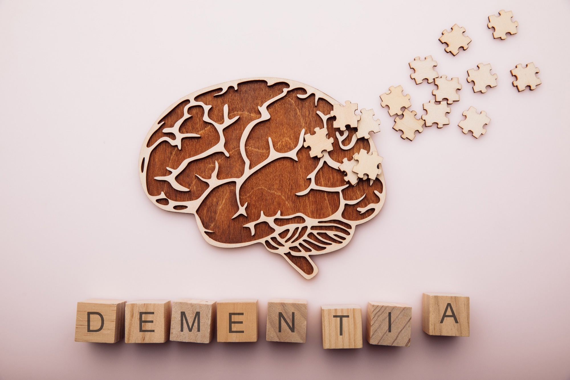Study: Alcohol use and risk of dementia in diverse populations: evidence from cohort, case–control and Mendelian randomisation approaches. Image Credit: Burdun Iliya / Shutterstock