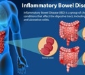 Western diet fuels IBD by derailing the microbiome - can precision nutrition turn the tide?