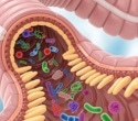 How the gut microbiome links obesity to colorectal cancer