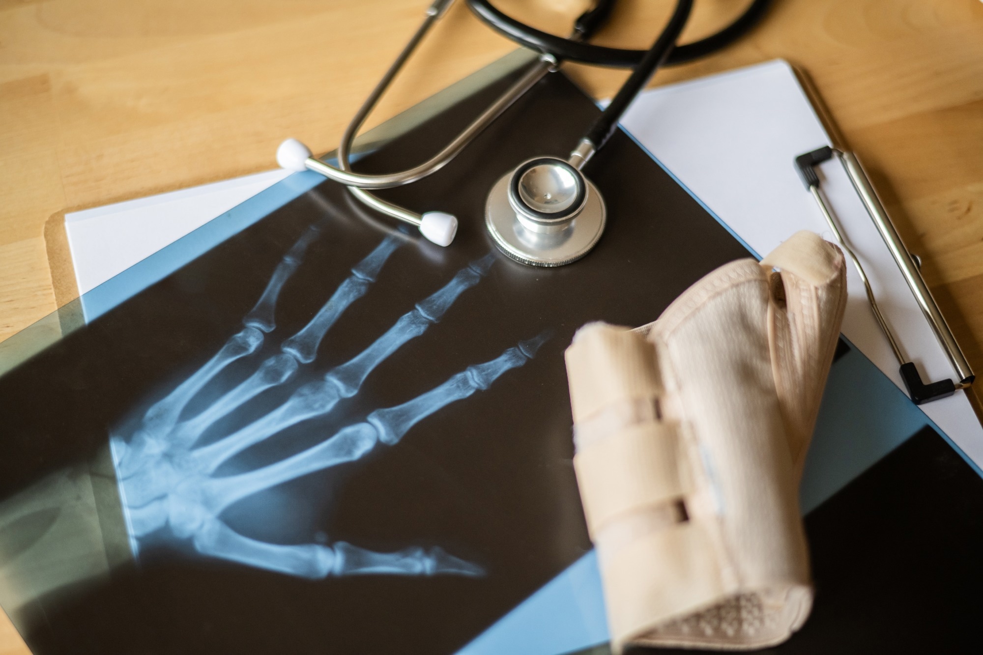 Orthopedic doctor examining a hand x-ray on a wooden desk, with a stethoscope and an orthopedic brace resting on the radiography,