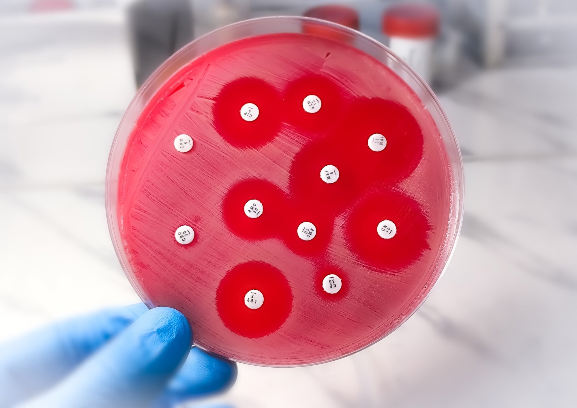 Petri dish with blood agar. Antibiotic susceptibility test showing bacteria resistant to antibiotic disks