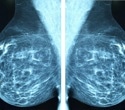 Study identifies PUF60 as a critical vulnerability in triple negative breast cancer