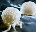 Researchers discover how aggressive breast cancer controls protein production
