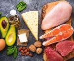 Potassium citrate wards off kidney stones in epilepsy patients on ketogenic diet