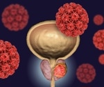 Landmark prostate cancer screening trial launches in the UK