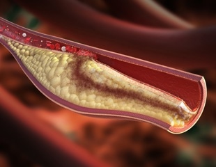 Monash experts urge funding for national genomic screening to prevent disease