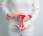 New research paves the way for non-hormonal endometriosis treatments
