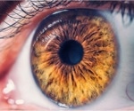 Breakthrough $20 million OCT project aims to revolutionize eye health screening