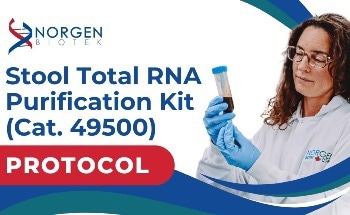 How to Purify Total RNA From Fresh or Frozen Stool Samples